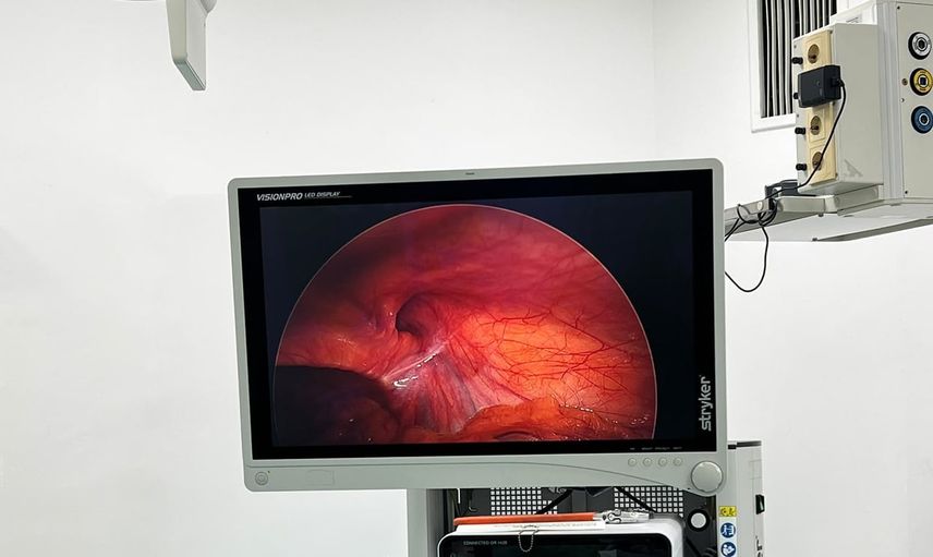 Kamera ve laparoskopik müdahaleyle 3 yıllık kasık ağrısı son buldu