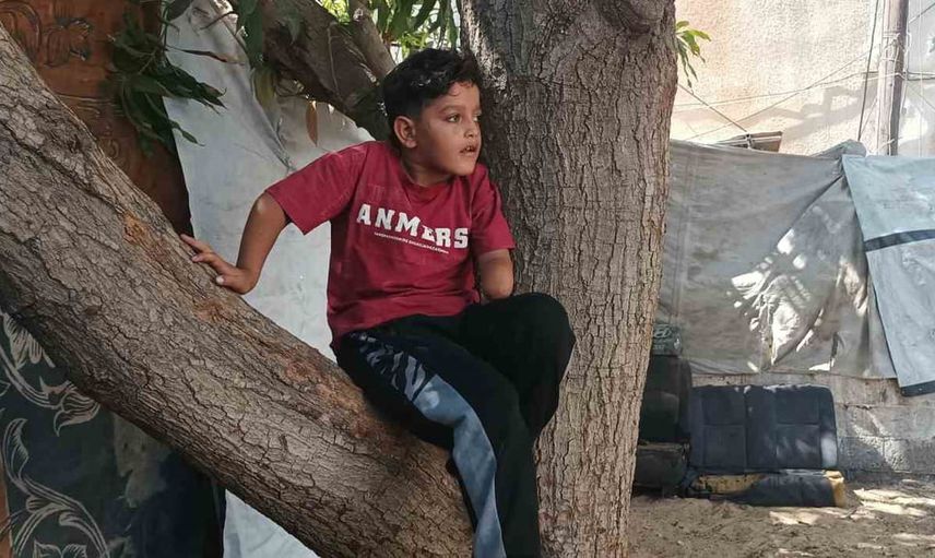 Kayıplarıyla büyüyen Kinan yeni protez için yardım bekliyor