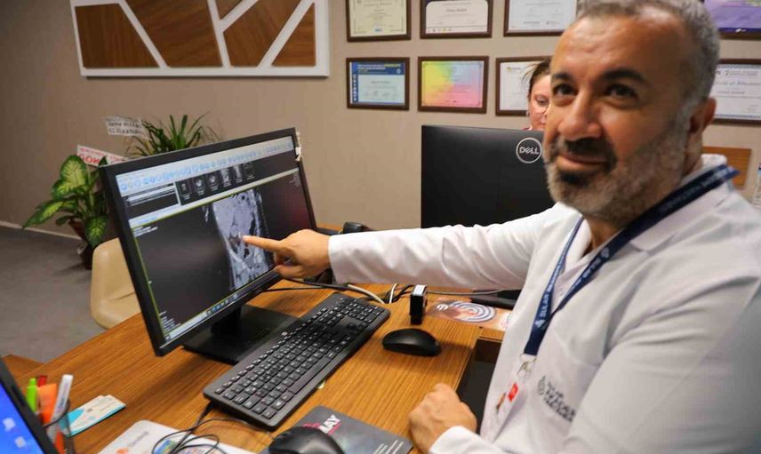 Erken tanı hayat kurtardı: 1 yaşındaki bebeğin böbreğinden 2 santimetrelik taş alındı