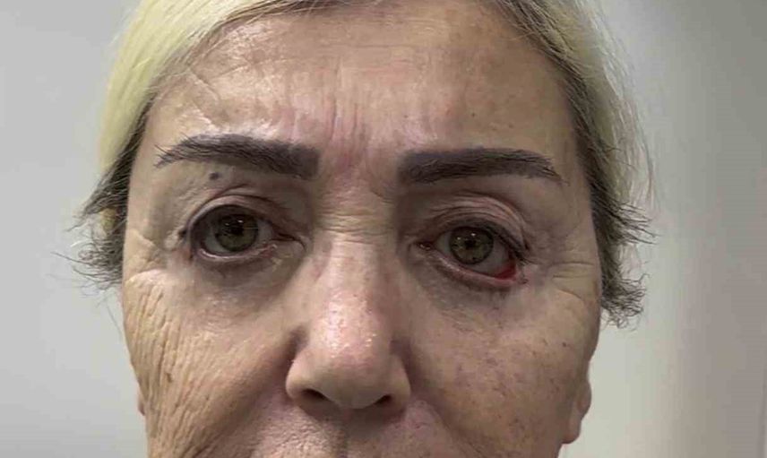 Seda Sayan'ın ablasının 3 yıllık estetik dönüşümü doktorundan paylaşıldı