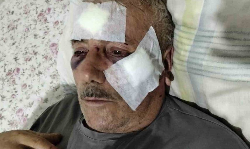 Muşta iddiasını reddetti: 'müvekkilim kesinlikle kullanmadı'