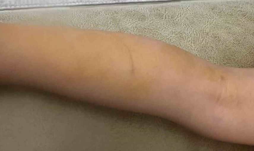 Halfeti'de başıboş köpek saldırısı: 3 yaşındaki çocuk yaralandı