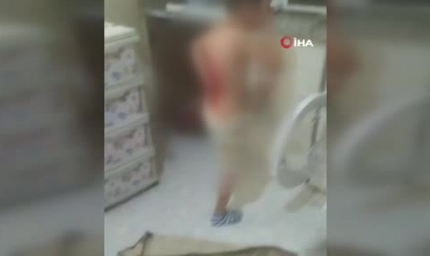 Arnavutköy'de oyun yerine saldırı iddiası: 12 yaşındaki çocuğun sırtında üçüncü derece yanık