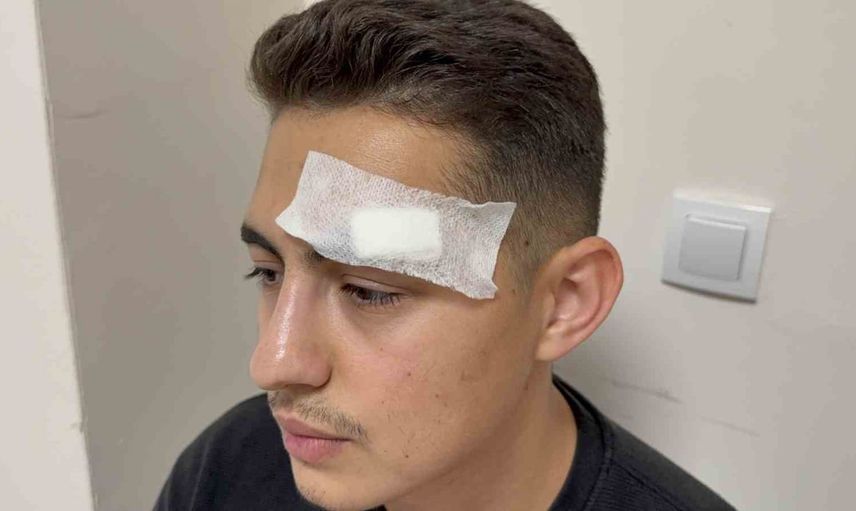 Hastanede şiddet: röntgen teknisyenine su ısıtıcısıyla saldırı