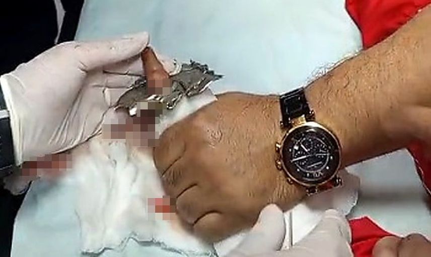 Bitlis'te oyun sırasında dolap halkasına sıkışan parmak itfaiyenin müdahalesiyle kurtuldu