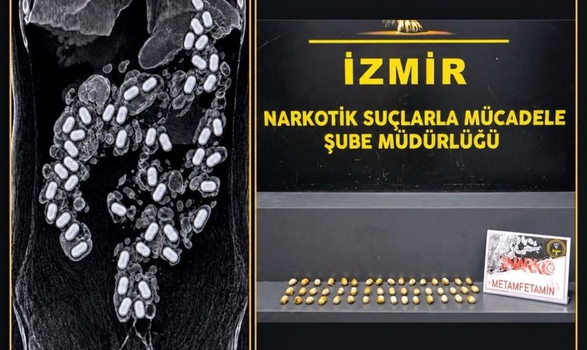 Havalimanında vücut paketleme yöntemi çöktü: İzmir'de midesinden 47 kapsül metamfetamin çıktı