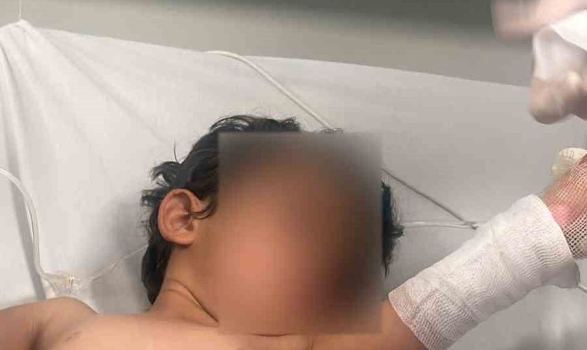 Kumçatı’da oyunla kesişen kaza: 3 yaşındaki kız kaynar suyla yaralandı