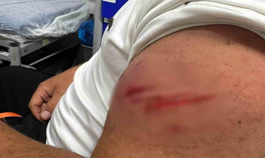 E-5'te aniden yola çıkan aracın çarpması motosikletliyi benzinliğe sürükledi