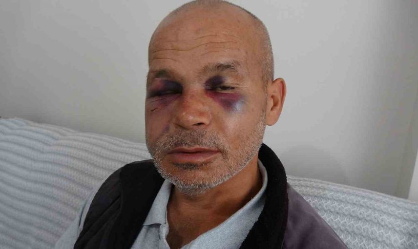 Kozan'da duyma ve konuşma engelli adama saldırı sonrası şüpheli serbest bırakıldı