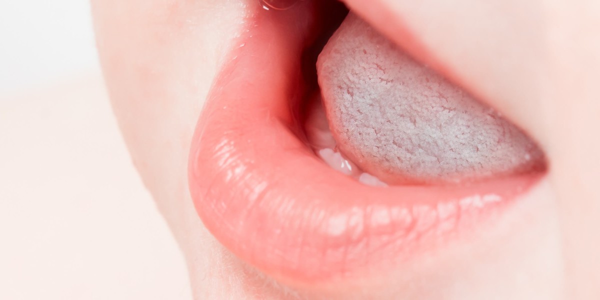 bebeklerde pamukçuk hastalığına dikkat edilmesi gerekiyor