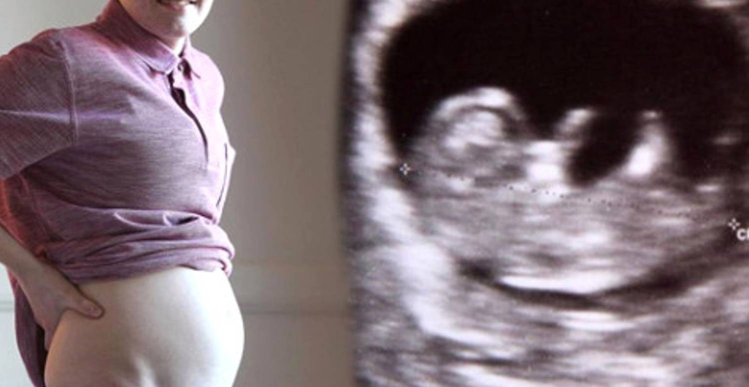 erkeklerde hamile olabilir