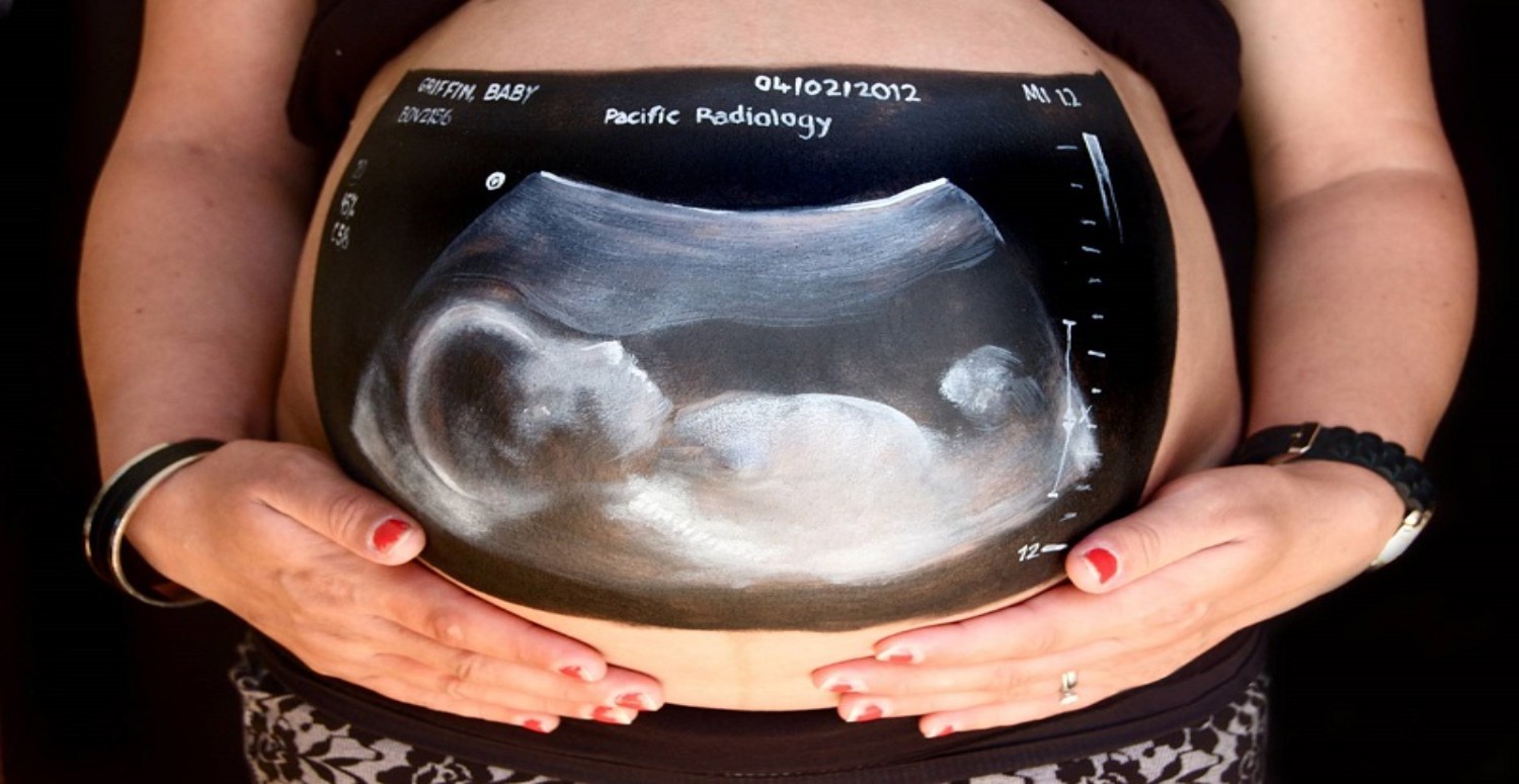 hamilelikte radrasyon