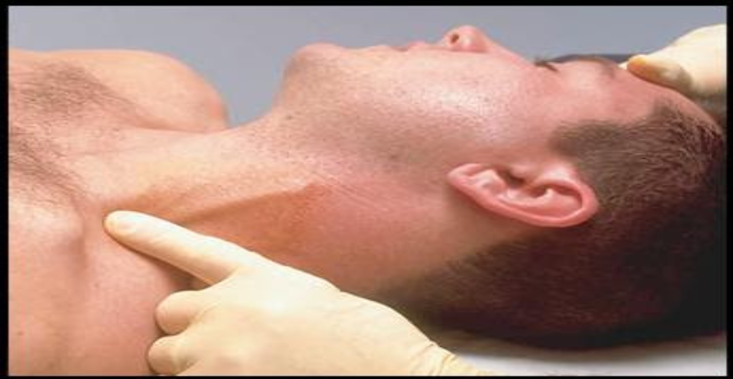 şah damarı belirtisi