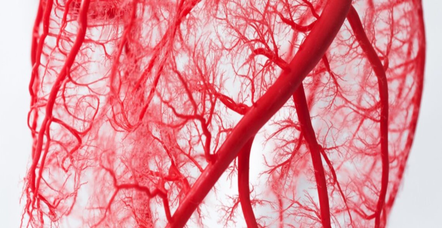 şah damarı tıkanması