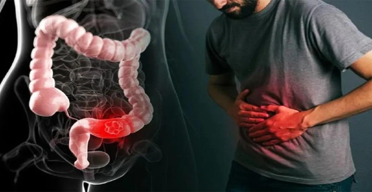 sindirim sistemi sorunları