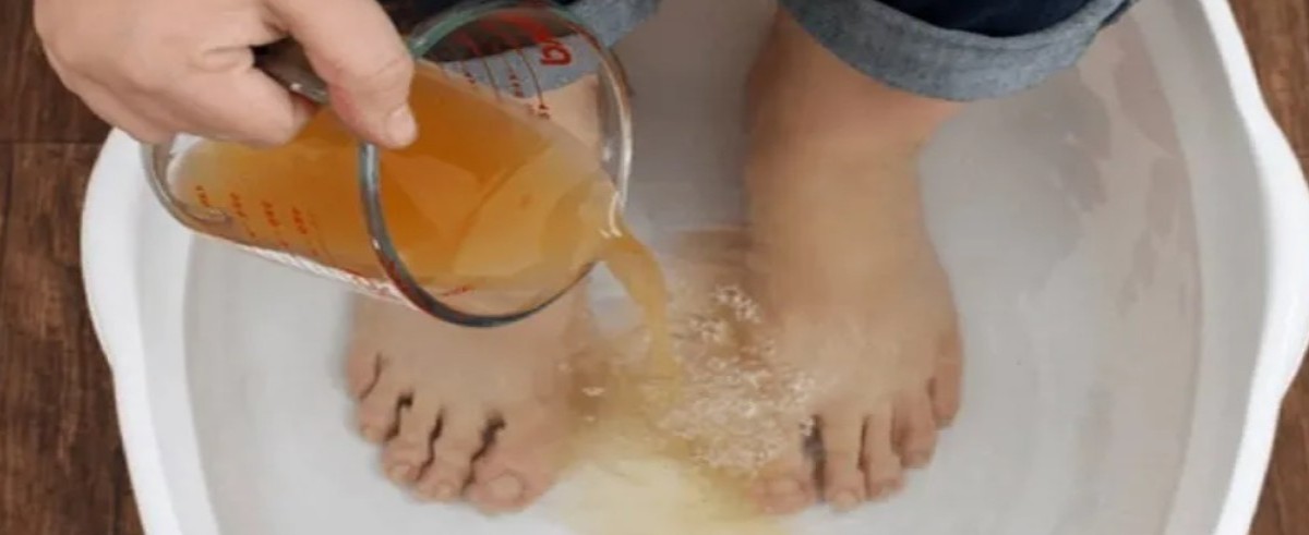 sirke ile nasırlara veda edin