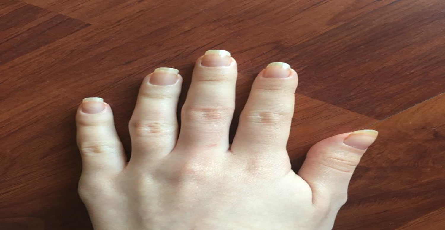 tırnak uzatma ne yapar