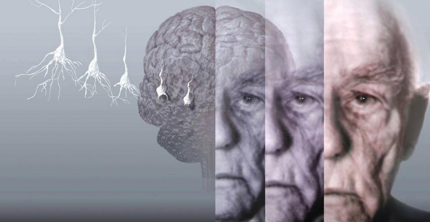 DEMANS NASIL ANLAŞILIR