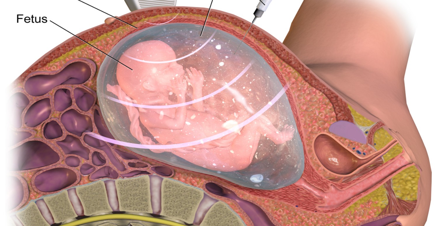 GEBEYKEN KOLAJEN MASKESİ