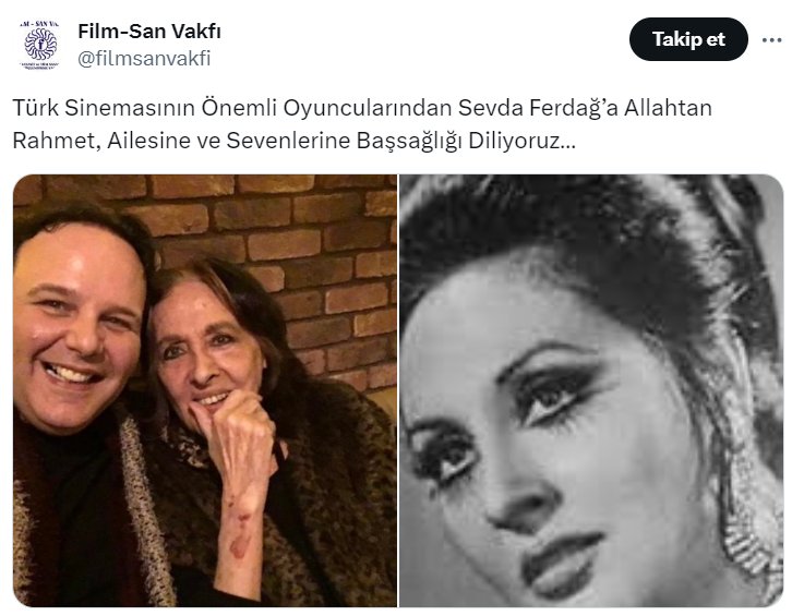 Yeşilçam'ın Yıldızı Sevda Ferdağ Hayata Veda Etti
