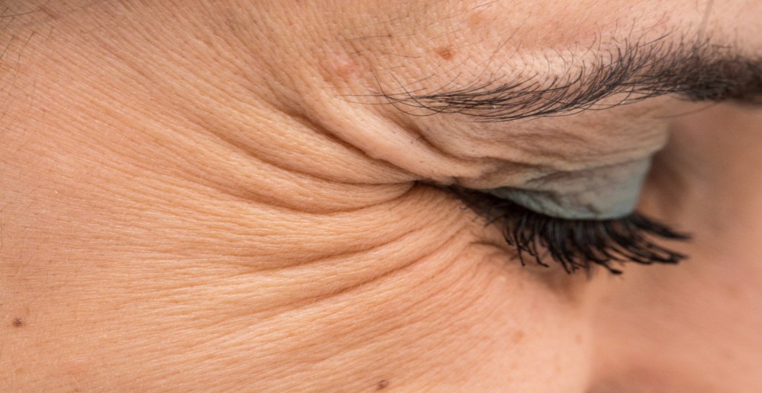 KAZ AYAĞI KIRIŞIKLIKLARI