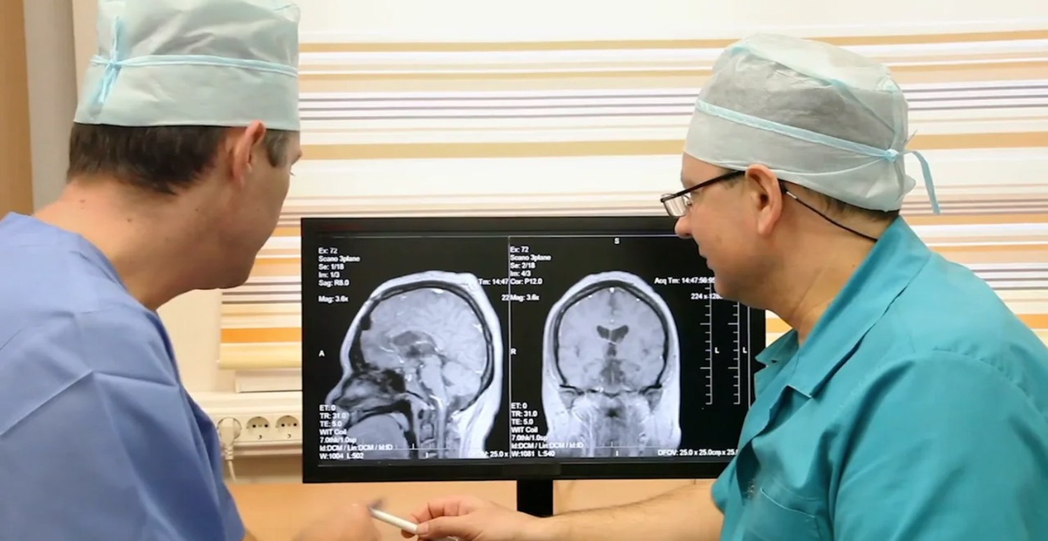 beyin tümörü tedavisi