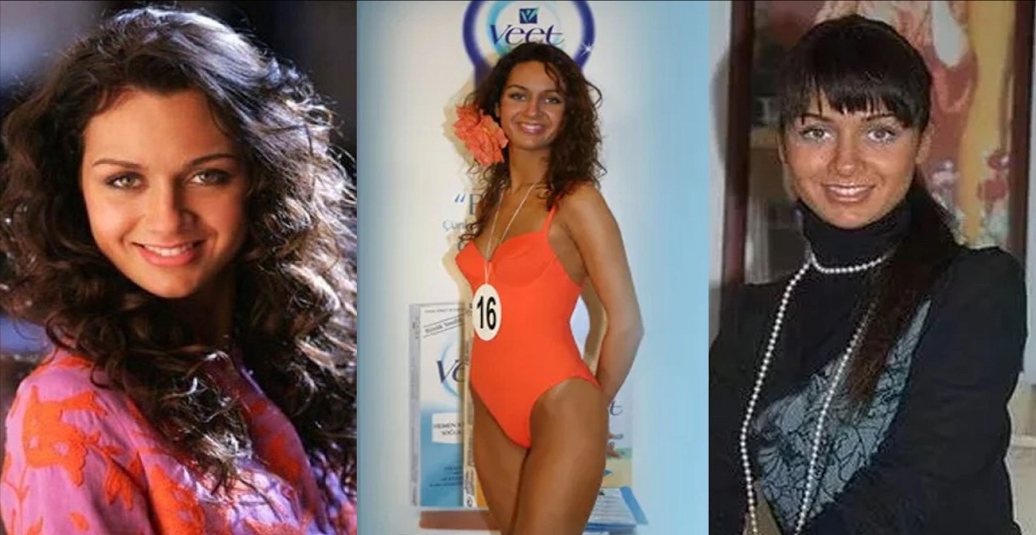 O ünlü de doğal güzel çıkmadı! İşte o ünlünün estetiksiz hali