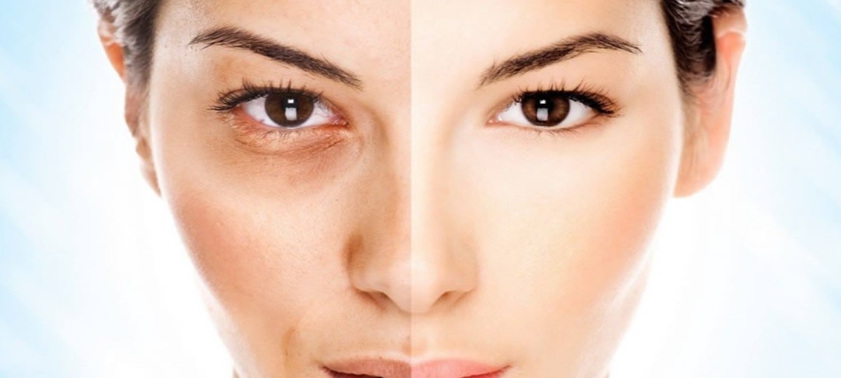 güneş sonrası cilt bakımı