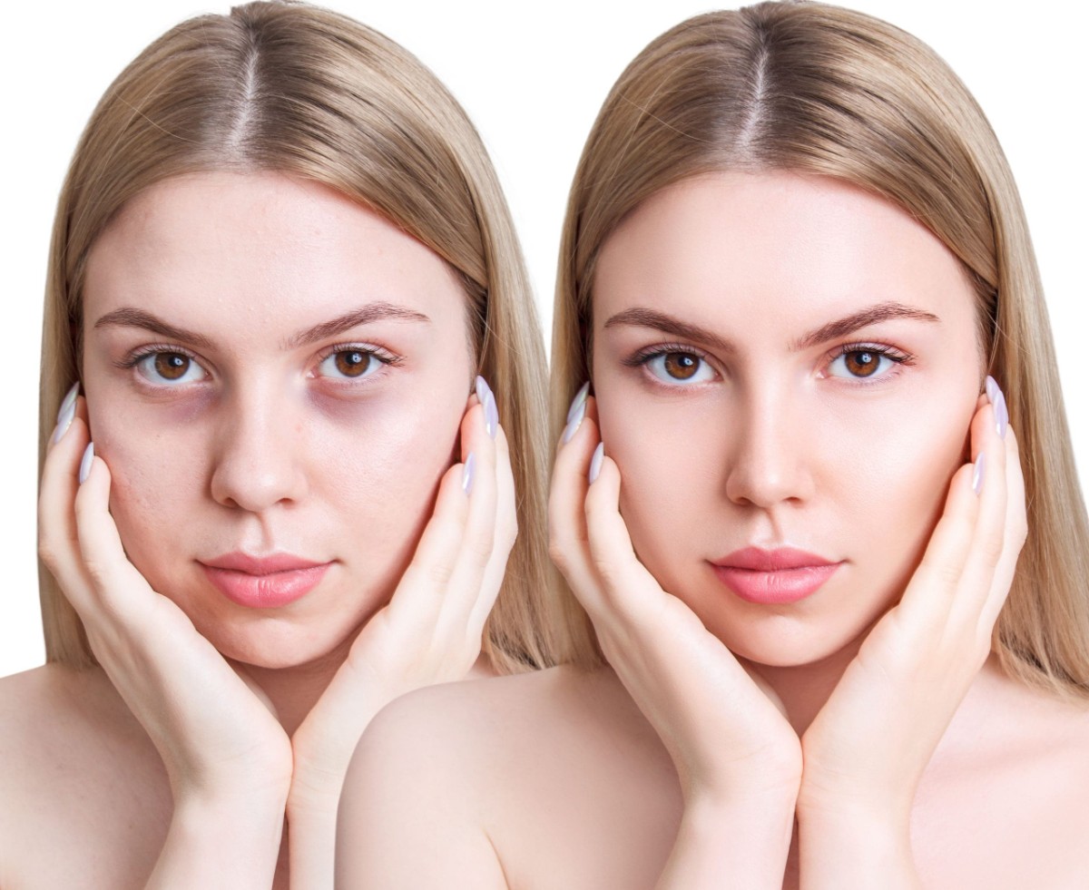 Koyu Halkalara Elveda