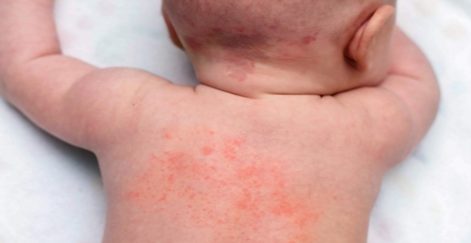 Yaz aylarının çilesi isilikten kurtulmanın bir yolu var! İki malzeme anında geçiriyor