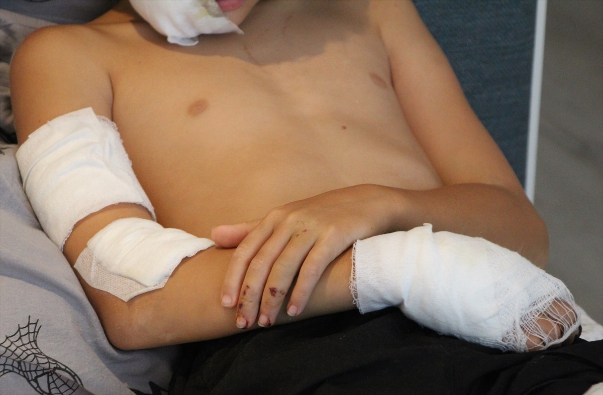 Antalya'nın Alanya ilçesinde sahipli köpeğin saldırısına uğrayan Kazakistan uyruklu 11 yaşındaki...