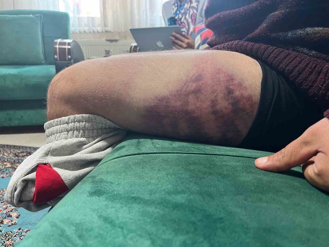 KOCAELİ'NİN İZMİT İLÇESİNDE YÜZDE 85 OTİZMLİ VE EPİLEPSİ HASTASI OLAN ERTUĞRUL ŞENOL'UN...