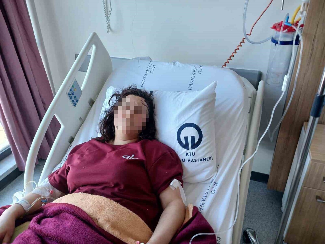 SALDIRI SONUCU DİL KÖKÜNÜN KEMİĞİNİN KIRILMASI VE DİLİNDE KESİKLER OLUŞMASI NEDENİYLE KONUŞAMAZ...