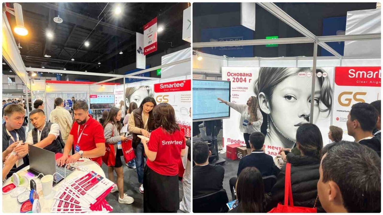 SMARTEE DENTİ-TECHNOLOGY, BU YIL YENİLİKÇİ ORTODONTİK ÇÖZÜMLERİNİ DENTAL SALON MOSKOVA, KAZDENT...