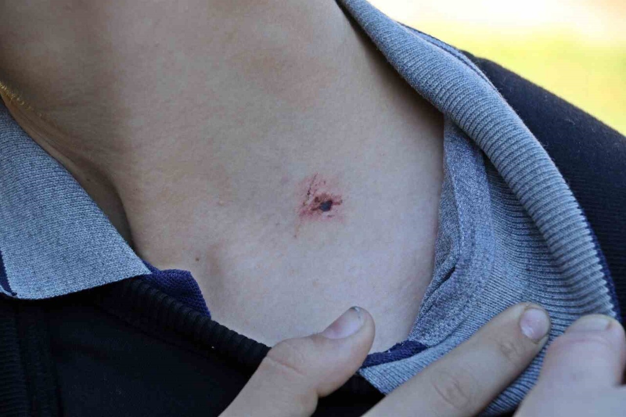 ANTALYA’NIN KEPEZ İLÇESİNDEKİ BİR ORTAOKULDA 7. SINIF ÖĞRENCİSİ AKRAN ZORBALIĞI SONUCU YERE...