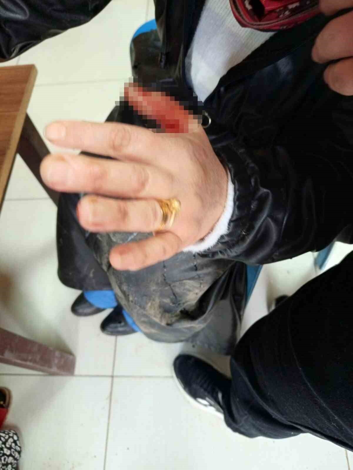 DİYARBAKIR'IN YENİŞEHİR İLÇESİNDE BAŞIBOŞ SOKAK KÖPEĞİ SALDIRISINA UĞRAYAN İKİ KİŞİ, KANLAR İÇİNDE...