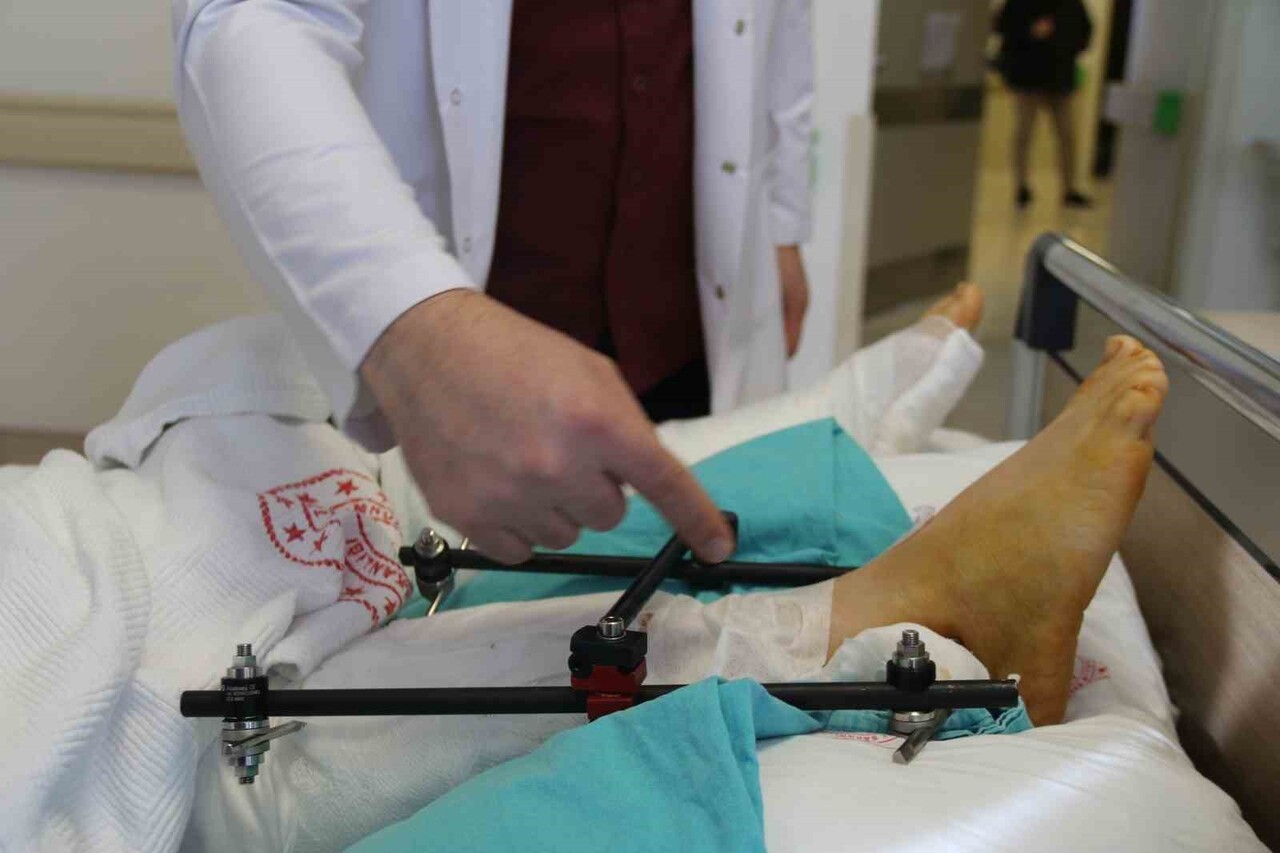 ESKİŞEHİR’DE 3 ÇOCUK ANNESİ FABRİKA İŞÇİSİ KADININ FORKLİFT TARAFINDAN PARÇALANAN BACAKLARI AMPUTE...