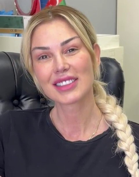 ÜNLÜ SANATÇI PETEK DİNÇÇÖZ’ÜN 8 AY ÖNCE GEÇİRDİĞİ ESTETİK OPERASYON SONRASI MAKYAJSIZ HALİ...