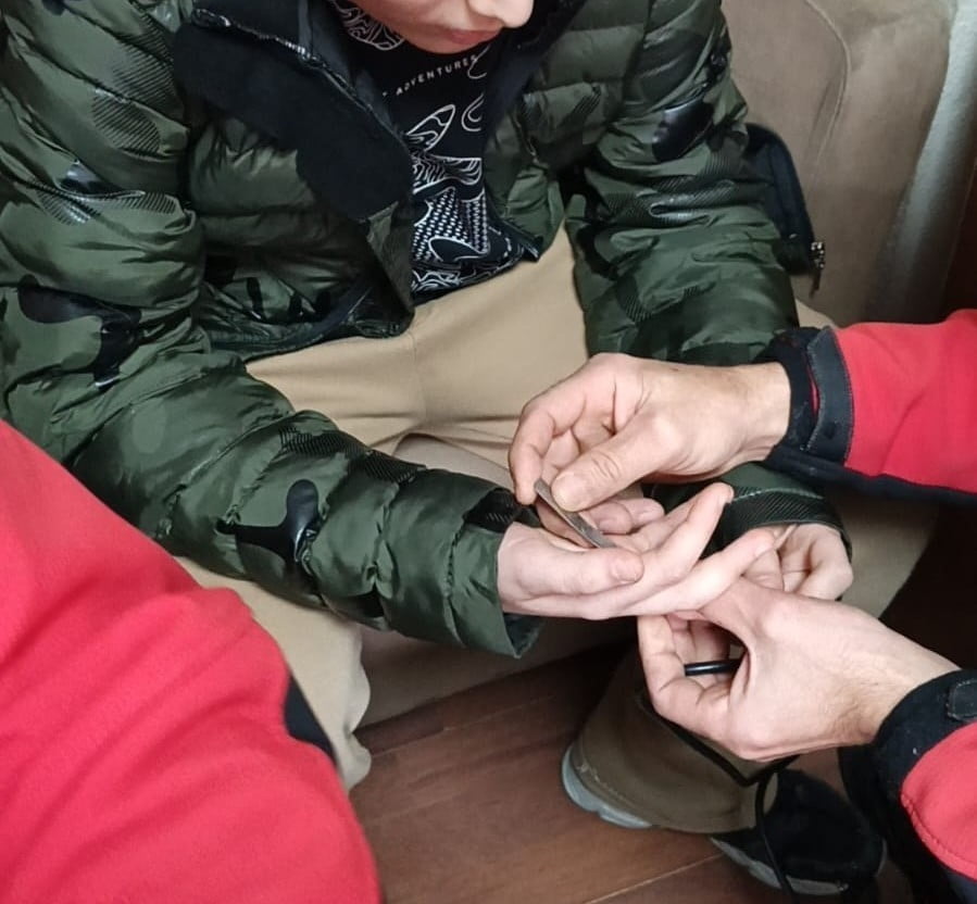 RİZE'DE OYUN OYNAMAK AMACIYLA MADENİ PARAYI PARMAĞINDA AKSESUARA DÖNÜŞTÜRMEYE ÇALIŞAN 10 YAŞINDAKİ...